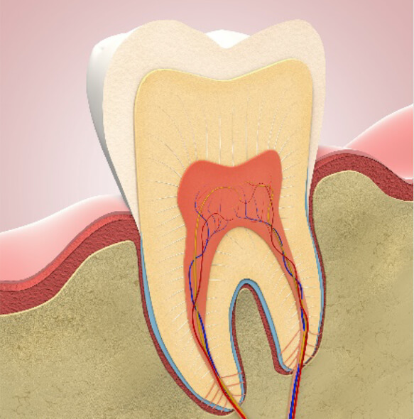 福岡市中央区で歯髄保存療法なら大濠公園にある辻本デンタルオフィスへ