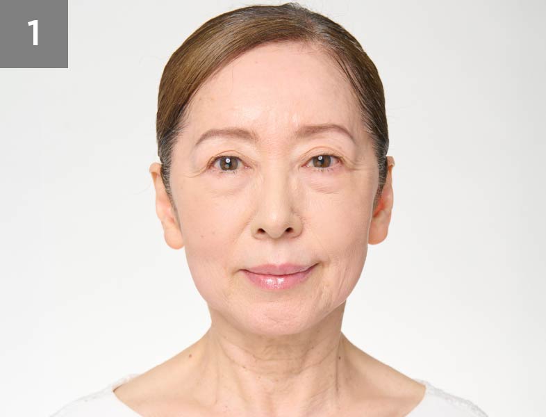 メディリフト ニードルリフトリンクルスムースベース｜Medi Lift