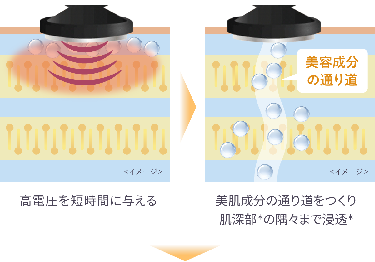 RF美顔器『フォトプラス シャイニー ネオ』ヤーマン公式通販サイト