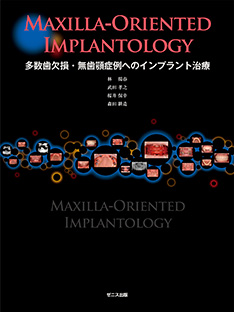 Maxilla-Oriented Implantology 多数歯欠損・無歯顎症例への