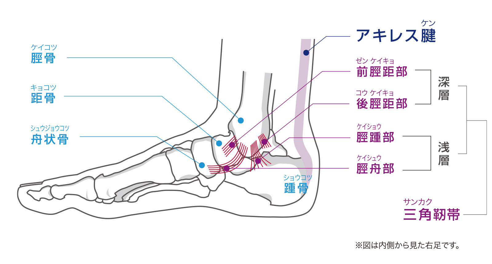 足首捻挫（足関節捻挫）とは｜原因・症状・応急処置と再発予防を徹底