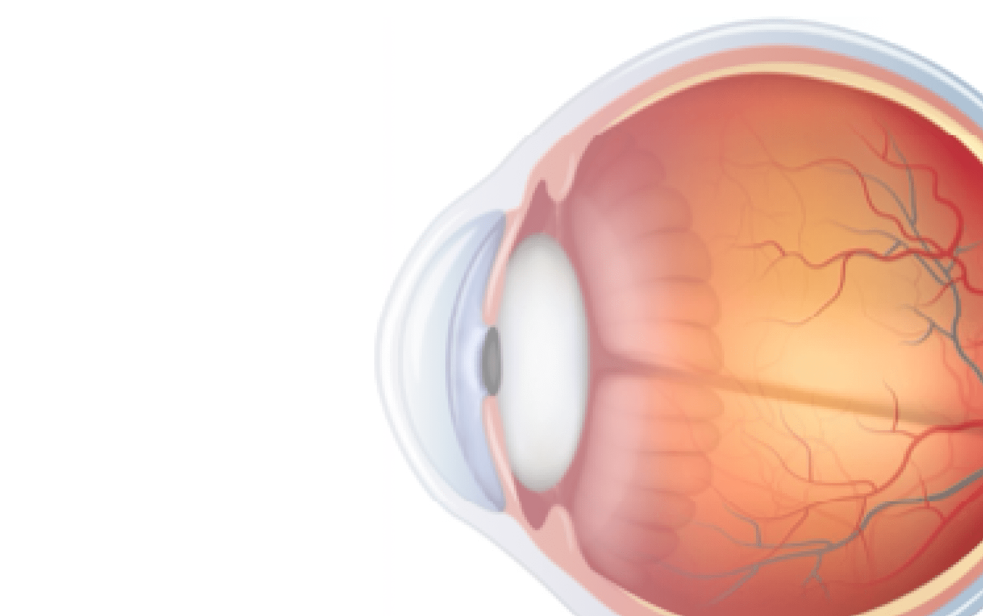 網膜剝離の前兆は？｜見逃しやすい初期症状と3つの治療法｜横浜・きく