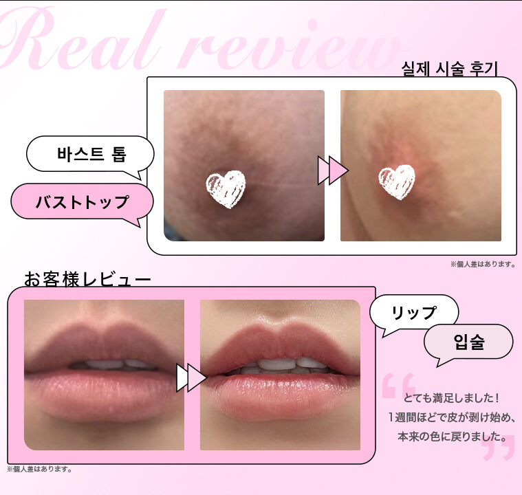 Roma Pink ローマピンク 乳首 アフタークリーム Roma Pink アフター