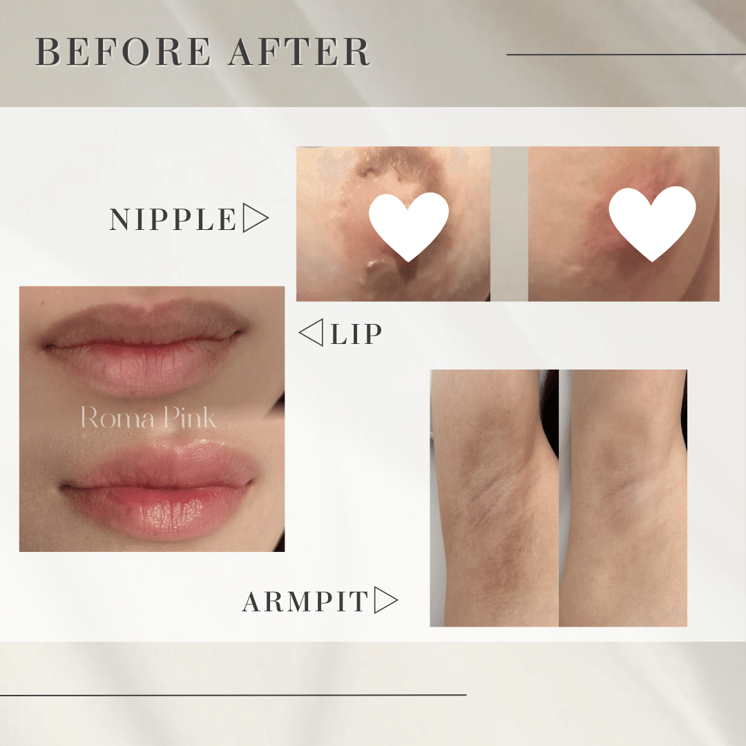 ローマピンクという新技術！！｜shu-salon