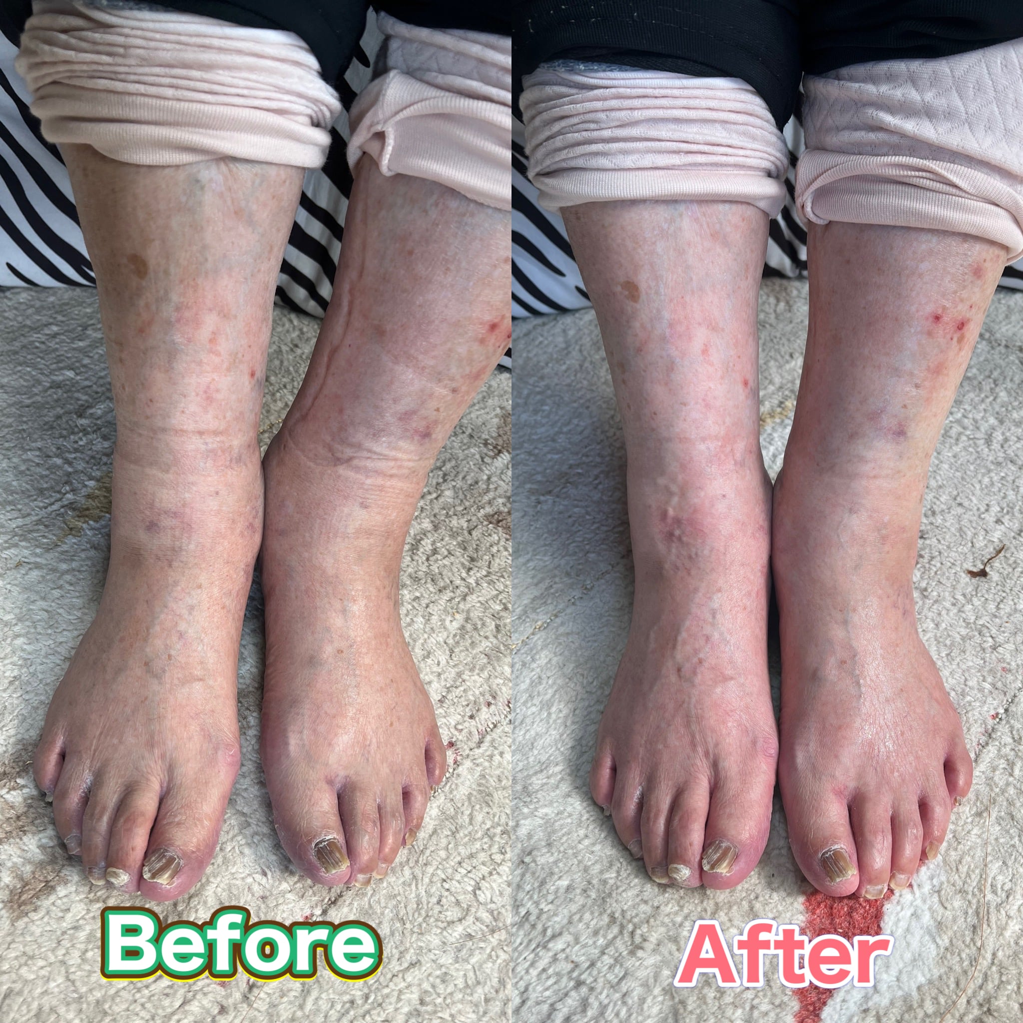 ファシアアミノジストローション チノザメソッド×ファシア | エステ