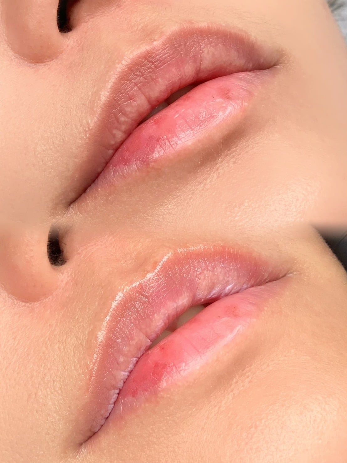 ローマピンク アフタークリーム(唇/ Iライン用) | Pay ID