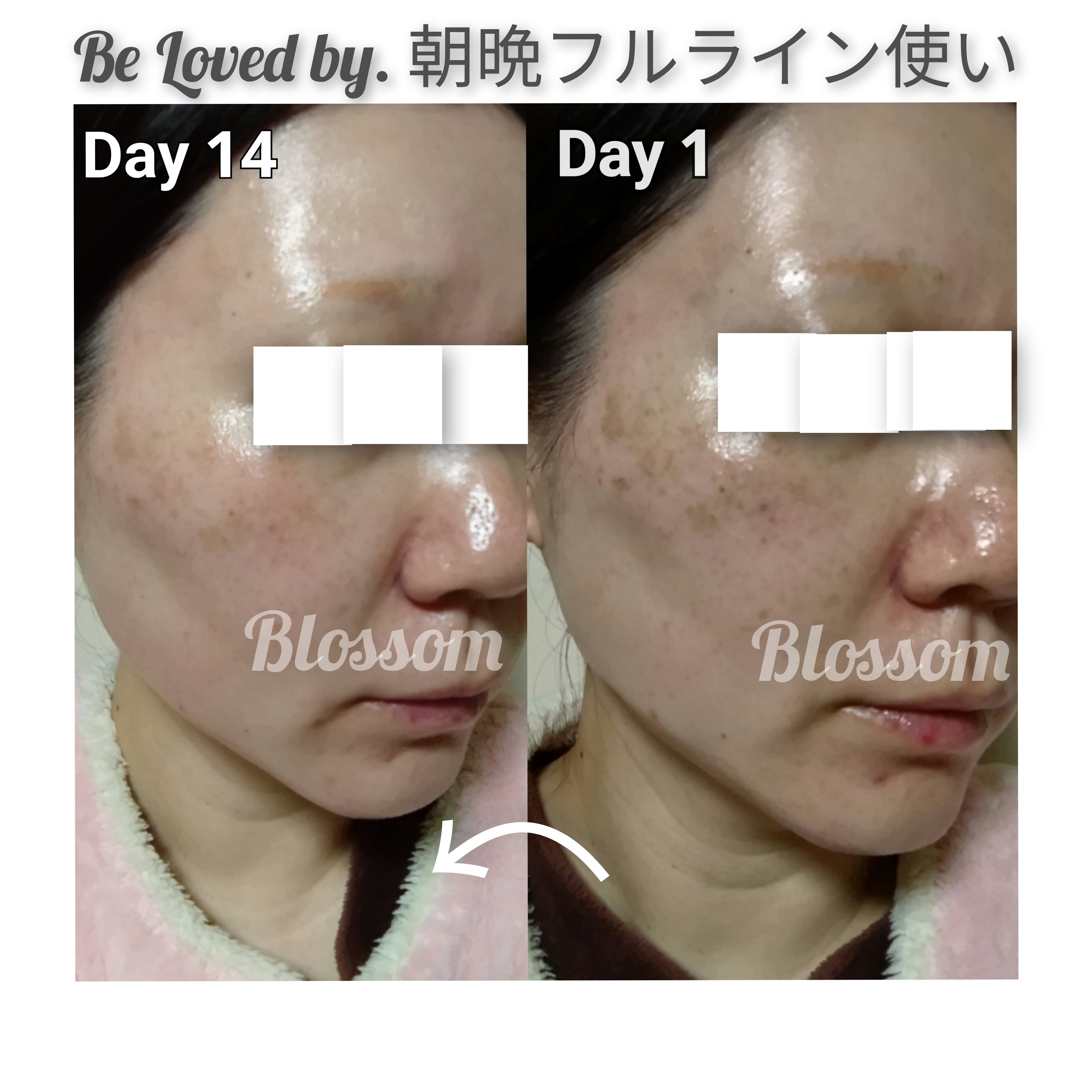 ⚿スキンセラム FL プレシャス 60ml Be Loved By ビーラブドバイ | Blossom