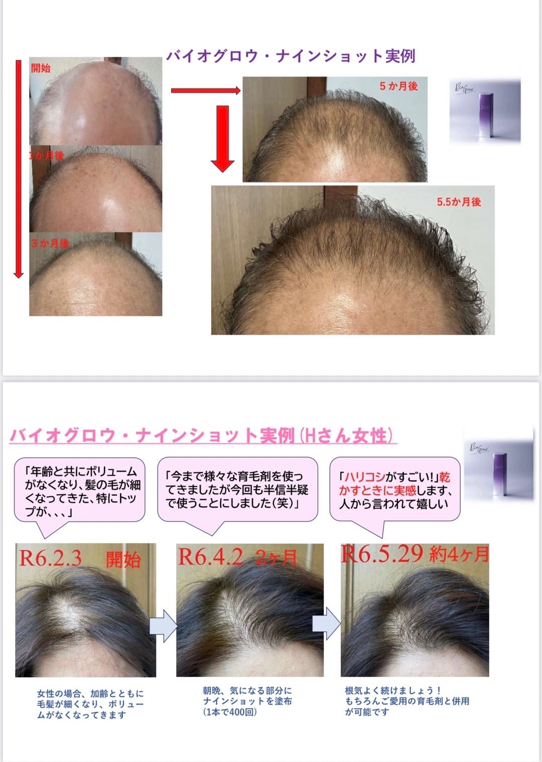 頭皮に革命】バイオグロウナインショット | 【ダーマショットセラム