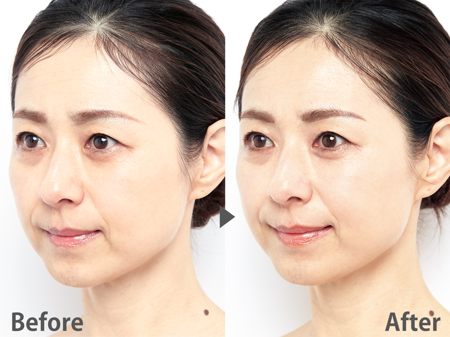 まるで瞬間コルセット】サロン専売品の高濃度炭酸パックが買えるのは美