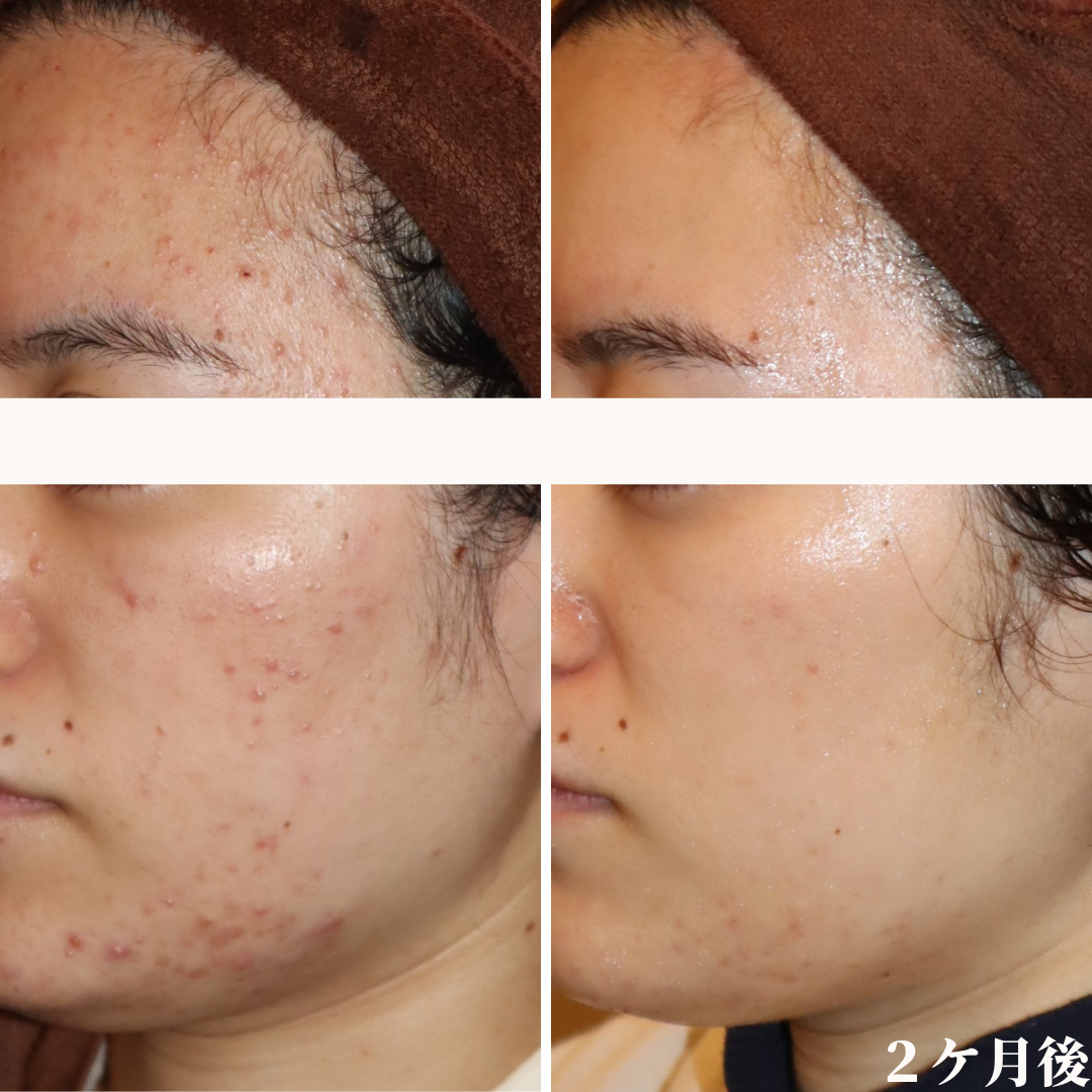 シミ、シワ、たるみ、ニキビ、あらゆる肌トラブルを改善に導くドクター