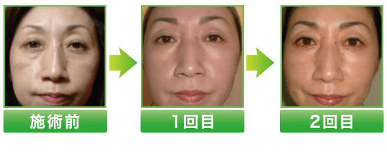 2B Bio トリートメントコース | 2Bバイオ トリートメントなら横浜元町