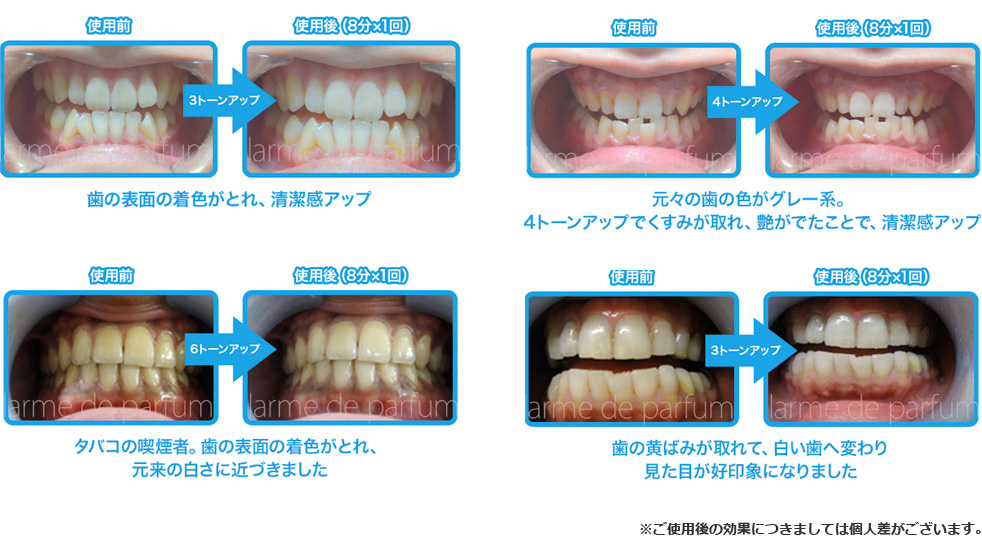 有吉ジャポンで紹介された - DR.WHITE（ドクターホワイト）送料無料／公式