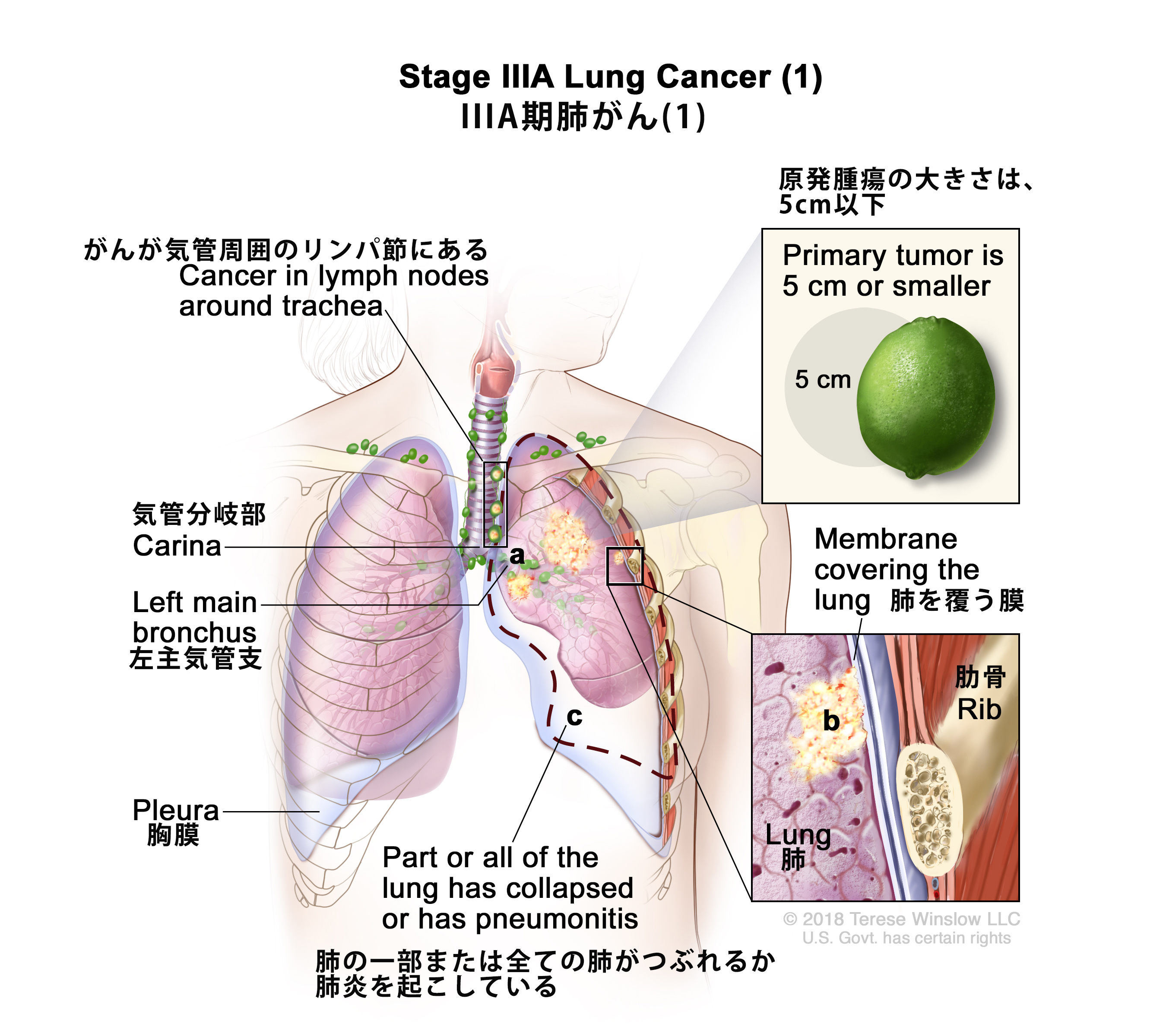がん情報サイト | がん情報各論：[医療専門家向け]