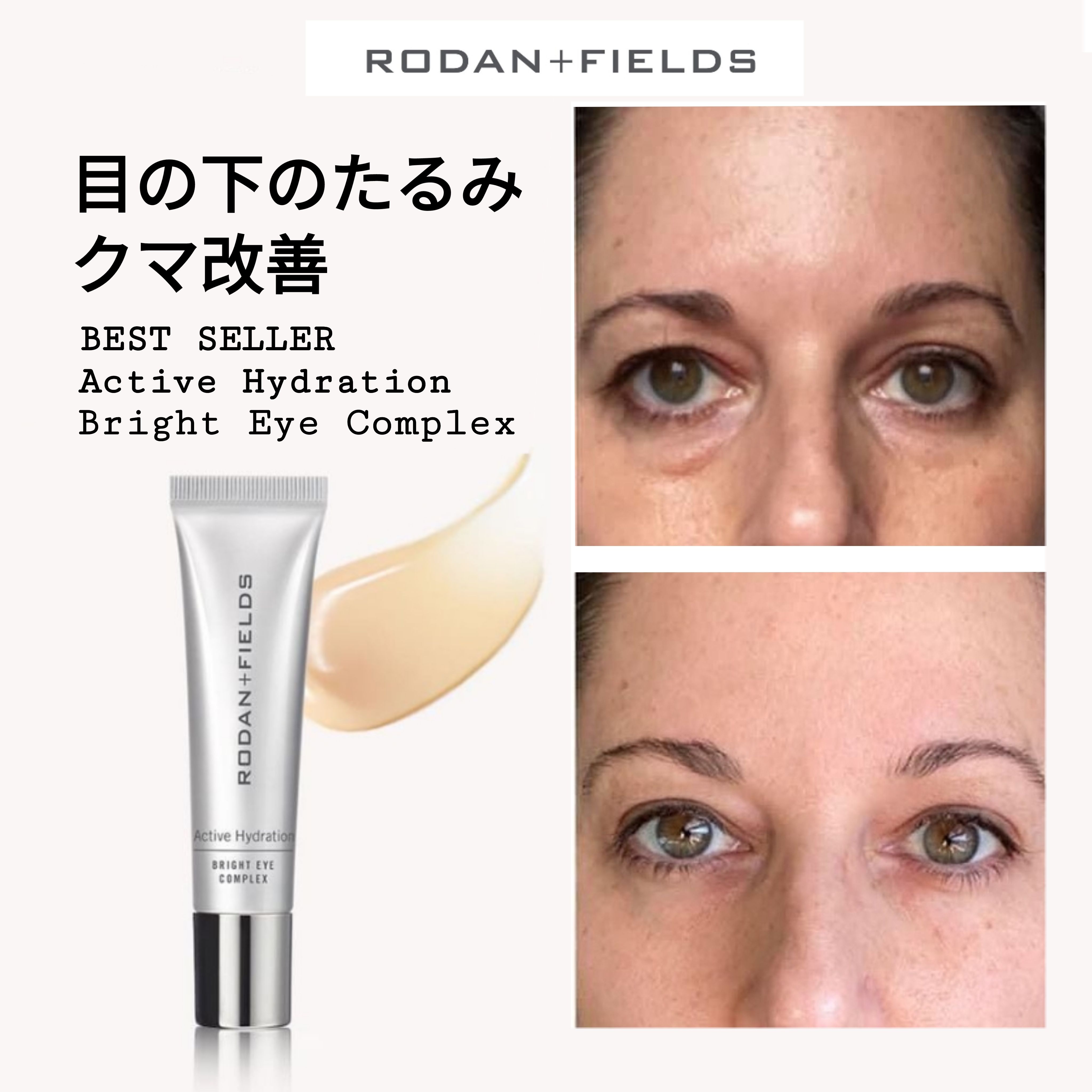 アワード賞 RODAN＋FIELDS☆目の下たるみ、クマ改善アイクリーム