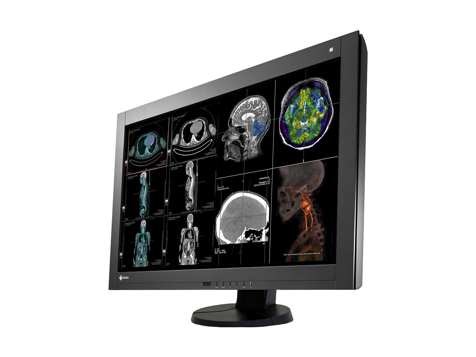 Eizo RadiForce RX440 4MP 30