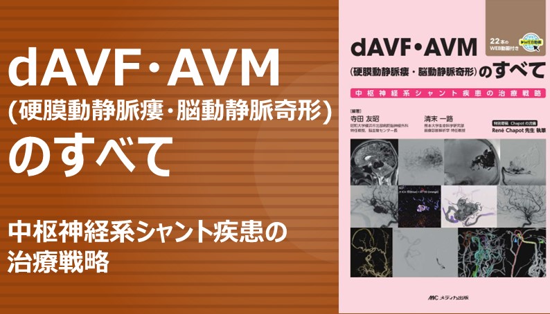 dAVF・AVM（硬膜動静脈瘻・脳動静脈奇形）のすべて｜動画ライブラリ