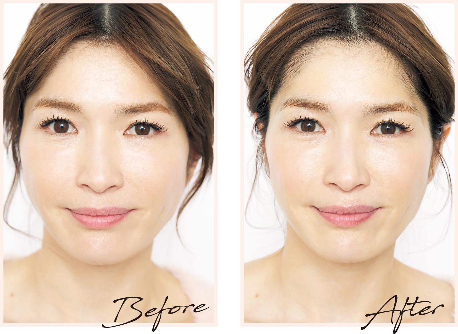 1回3分だけ】ヤーマンのフォトプラスシャイニーでリフトケア | 美ST ONLINE