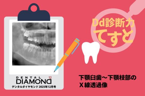 はじめに：臨床の玉手箱 保存修復編｜本のエッセンス - 歯科医療従事者