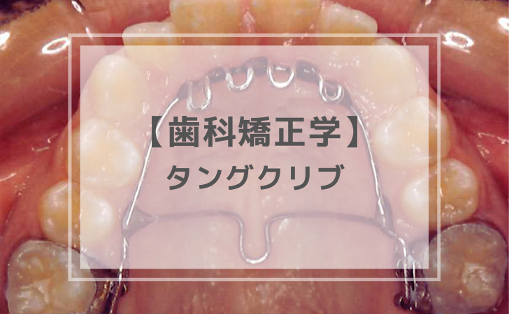 歯科矯正学：タングクリブ（計1問）【歯科医師国家試験】（2025年10月