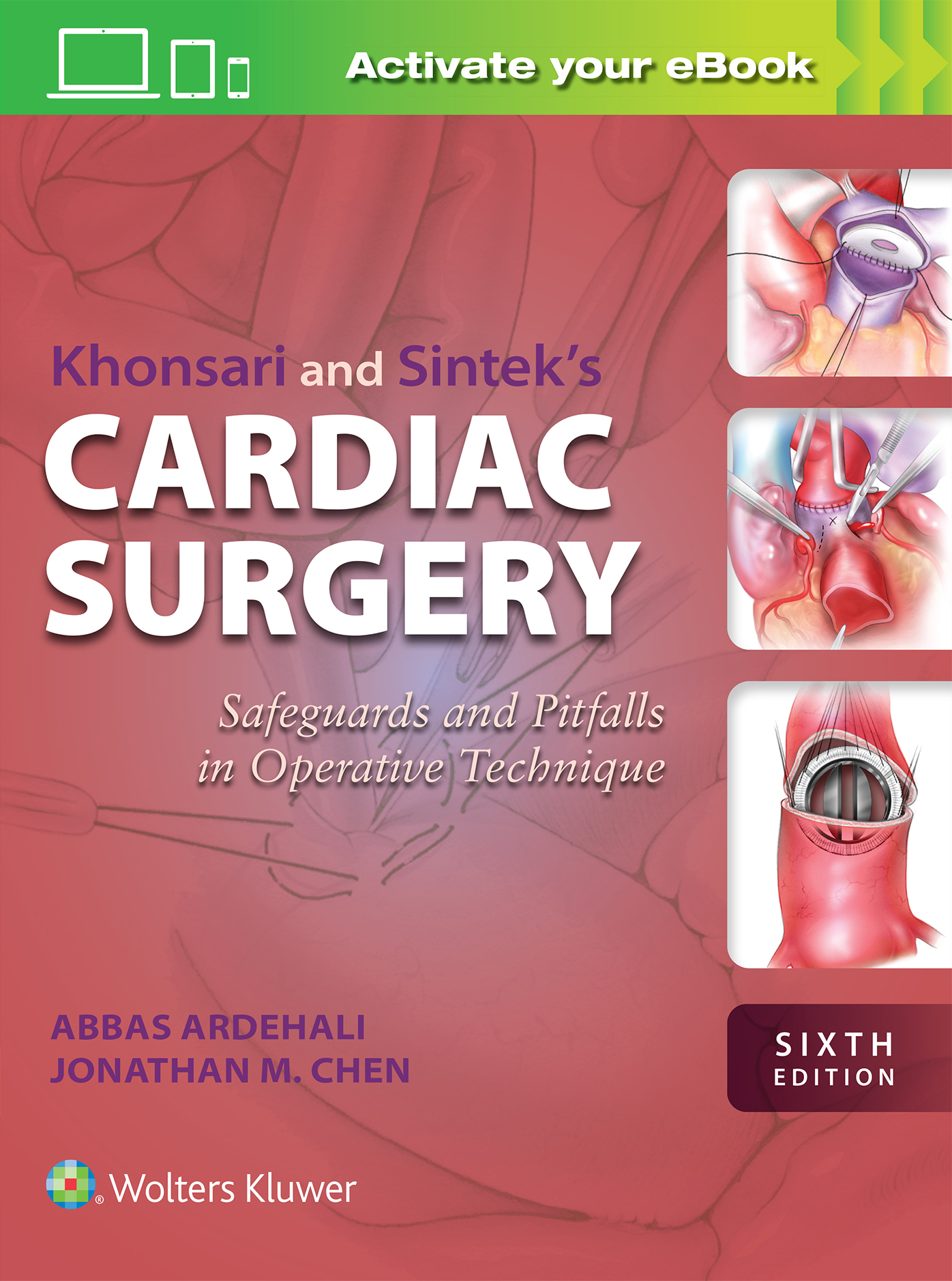 Khonsari & Sintek's Cardiac Surgery, 6th ed. - Safeguards