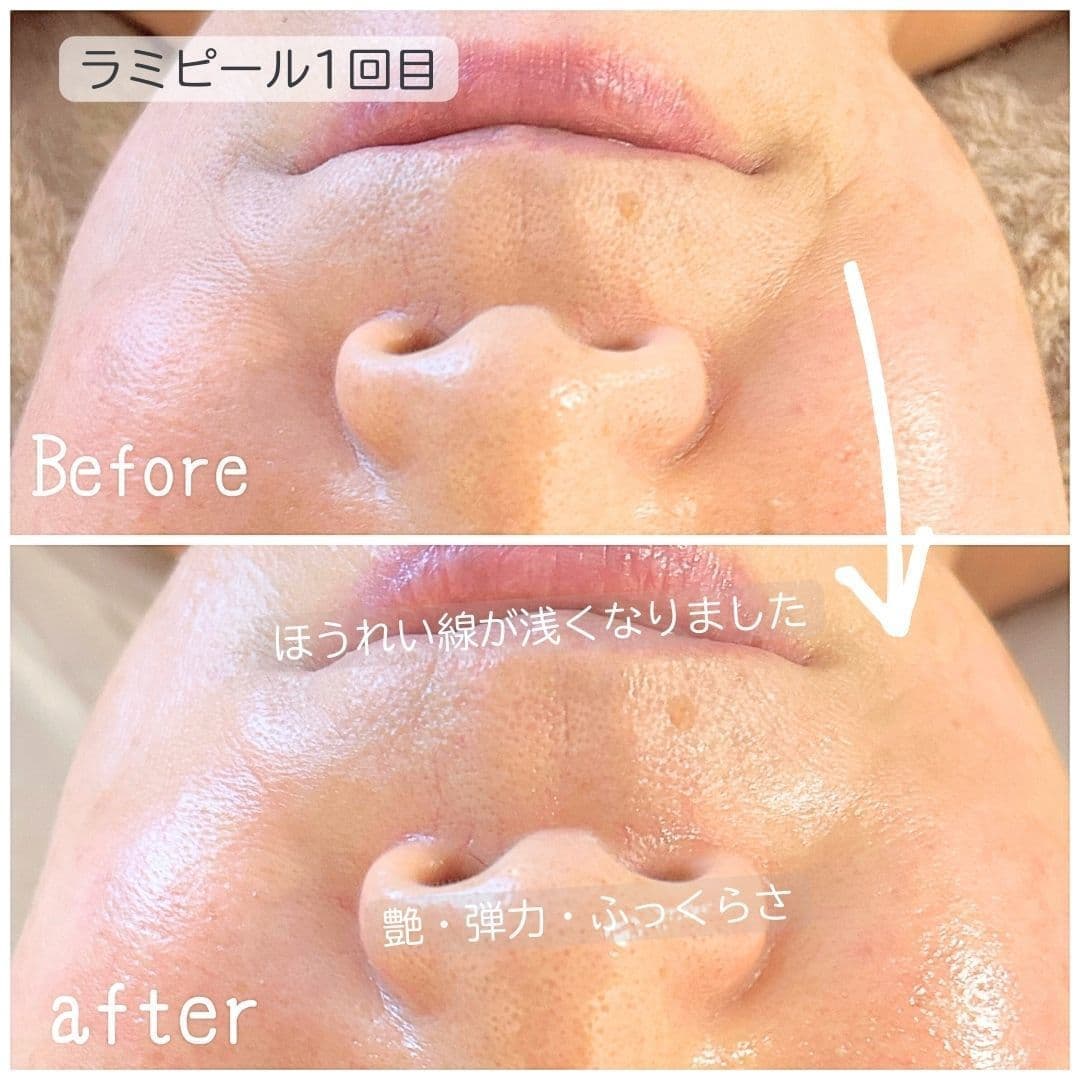 ラミピール＊シャンブル