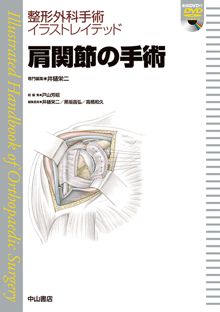 m3電子書籍 | 整形外科手術イラストレイテッド腰椎の手術［動画付き］