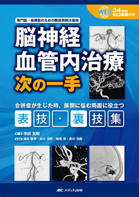 m3電子書籍 | 脳神経血管内治療 次の一手［動画付き］