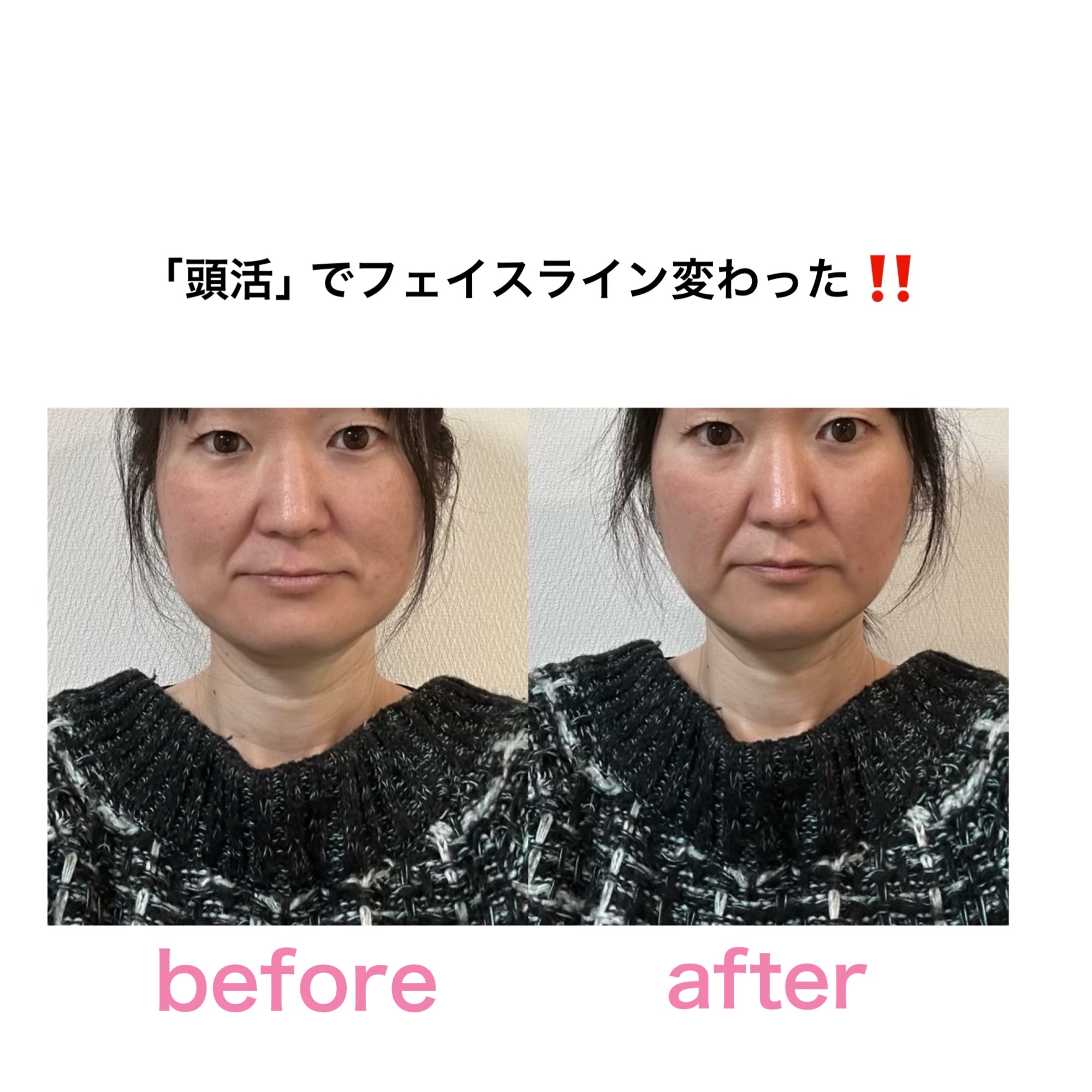 頭活 - エステサロン向け美容機器・基礎化粧品のフレキシアエステ