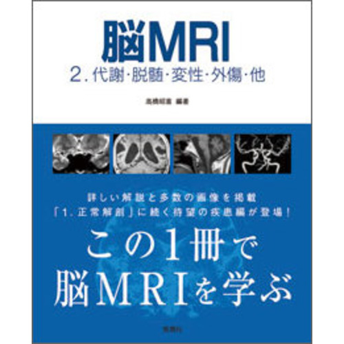 脳MRI 2．代謝・脱髄・変性・外傷・他|高橋 昭喜(編・著)|ショップ