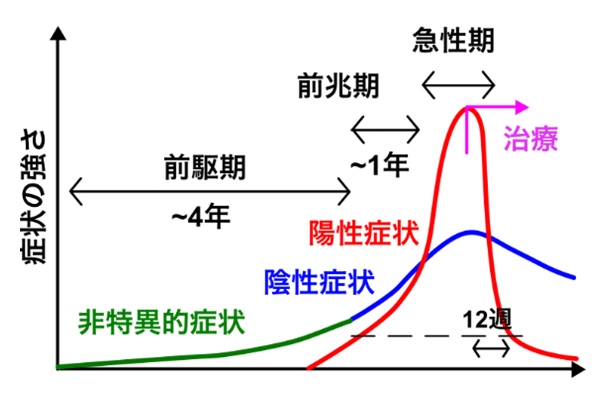 統合失調症の治療方法｜銀座心療内科クリニック