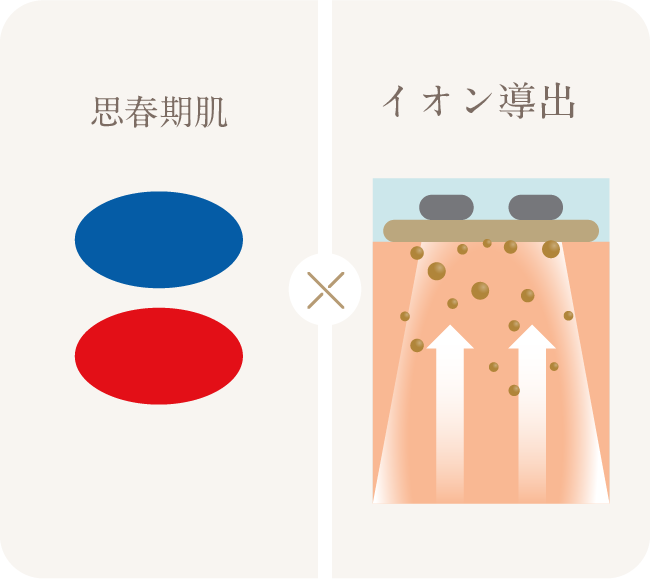 Exideal ovo (エクスイディアル オーヴォ) | LED美顔器 | LED美顔器