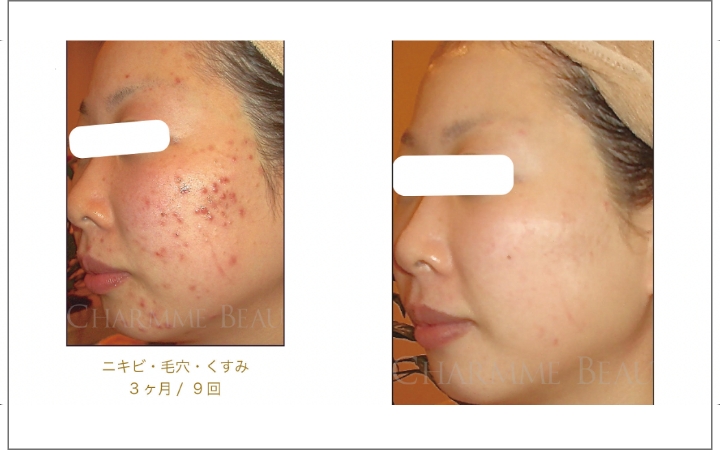 シャルム・ボー化粧品について | hanon（ハノン）|静岡県田方郡函南町