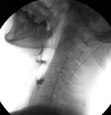 ボツリヌス治療外来 | 社会福祉法人あそか会 あそか病院