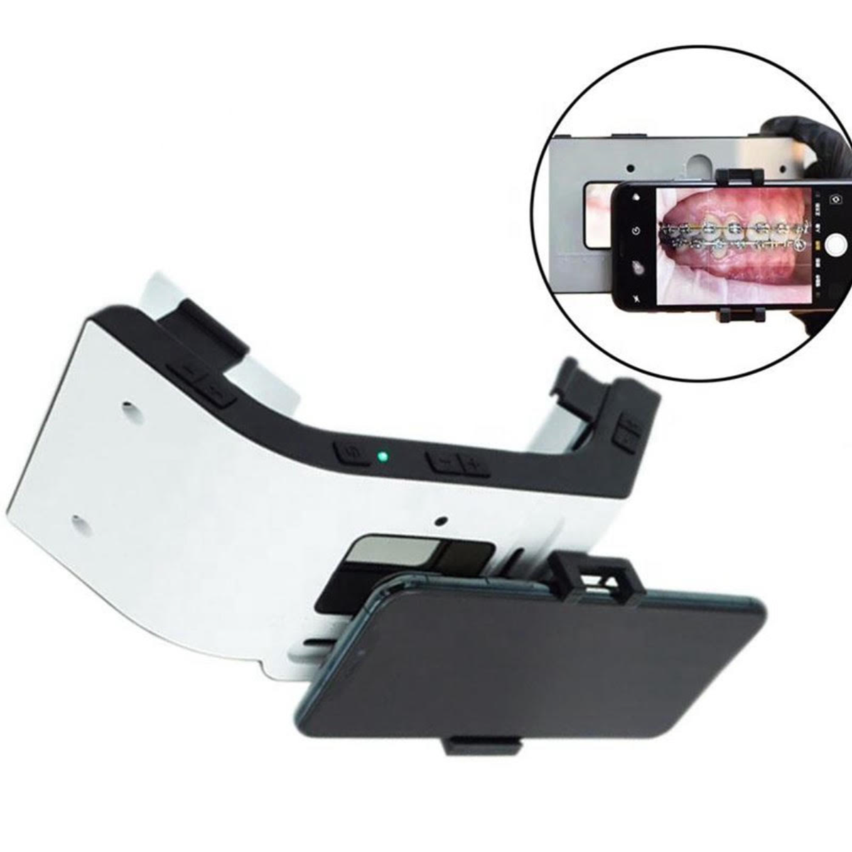 MOBILE DENTAL PHOTOGRAPHY LIGHT DSLR ALTERNATIVE | eBay