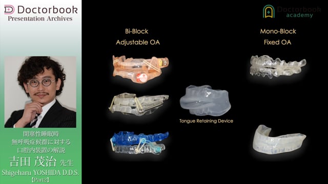 閉塞性睡眠時無呼吸症候群に対する口腔内装置の解説 | Doctorbook
