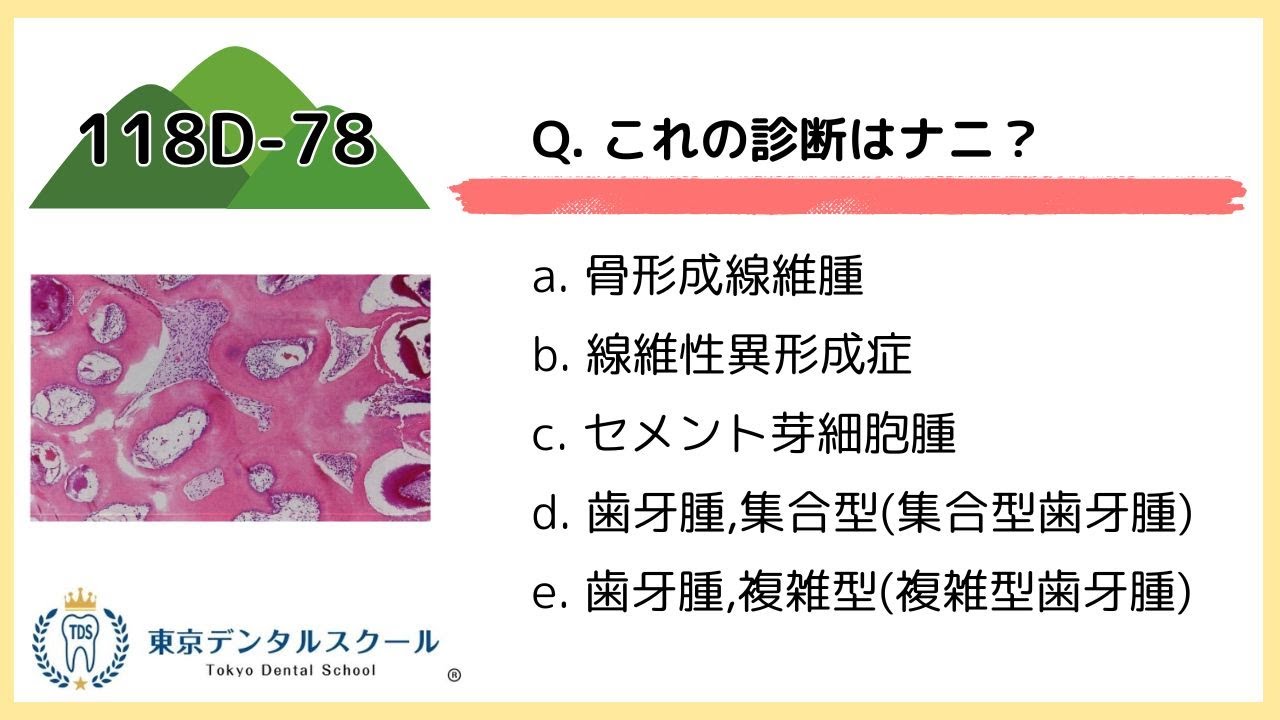 Try solving the clinical practice questions on odontoma! [National