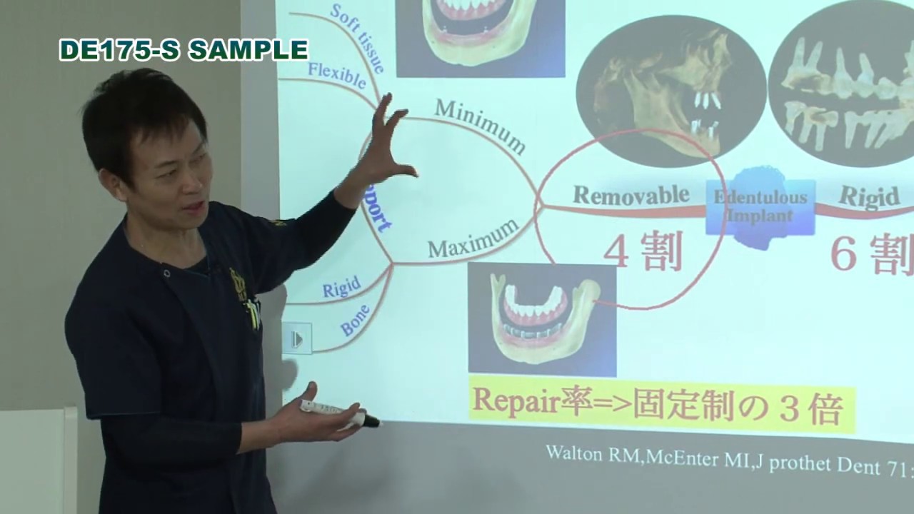 無歯顎多数歯欠損症例におけるインプラント治療 - YouTube