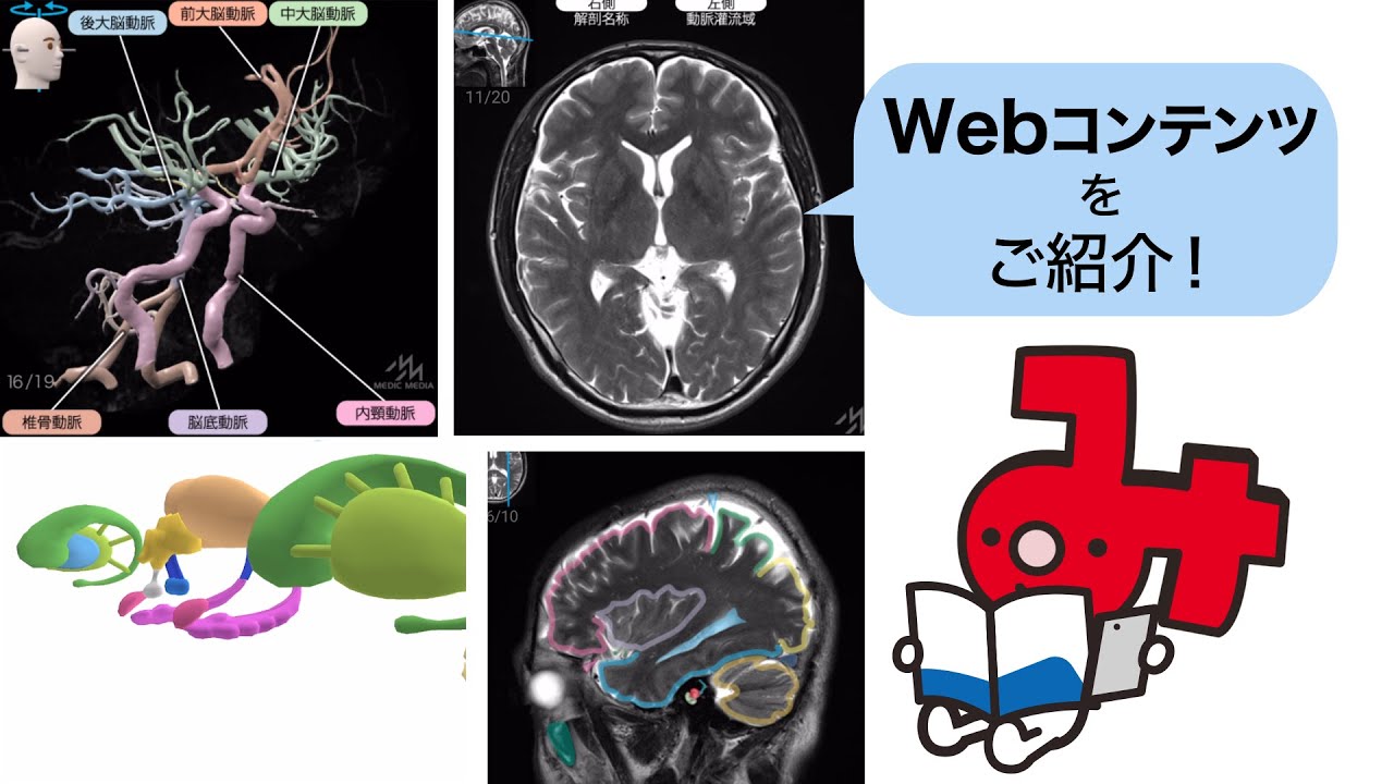 病気がみえる】vol.7 脳・神経 Webコンテンツをご紹介！ - YouTube