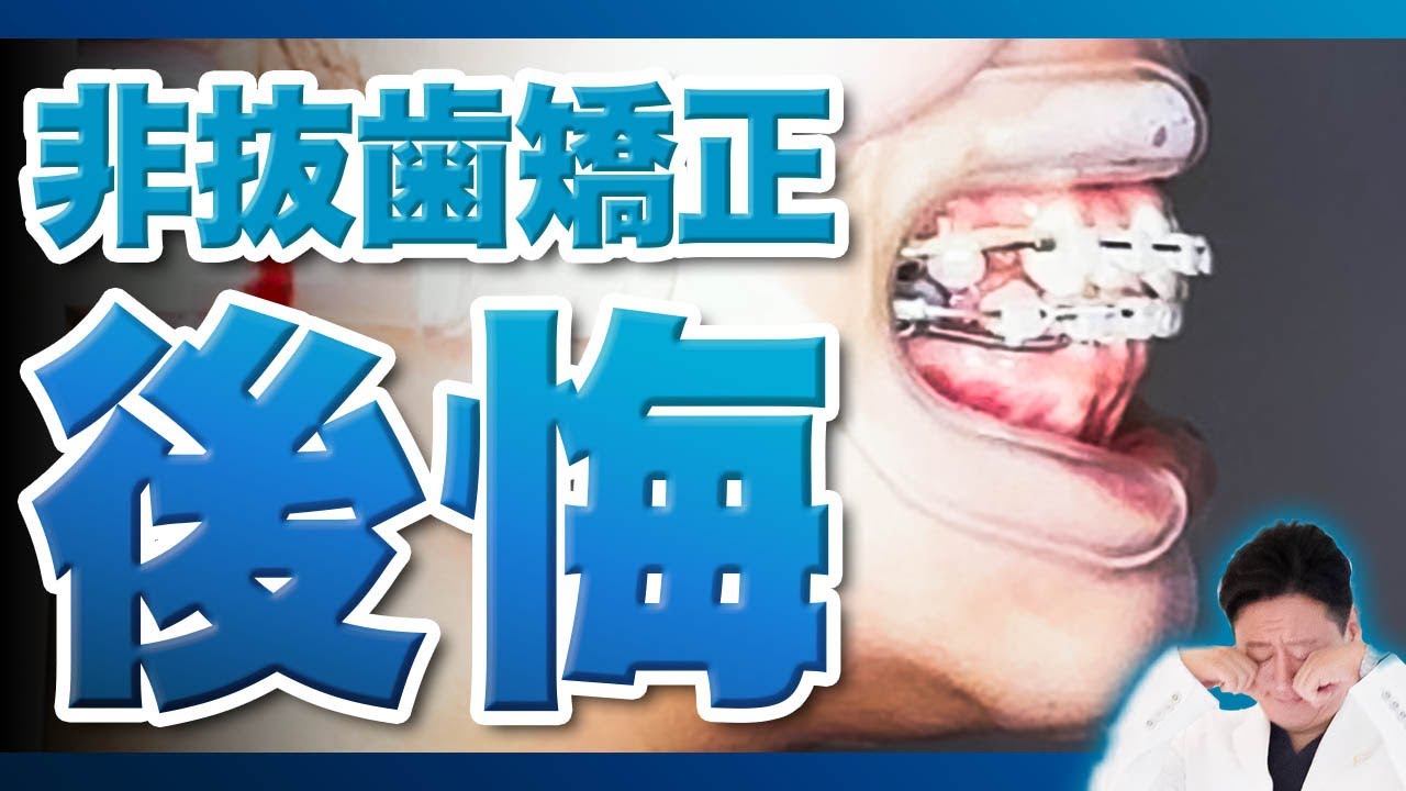 Re-orthodontics after orthodontic treatment! Orthodontic treatment