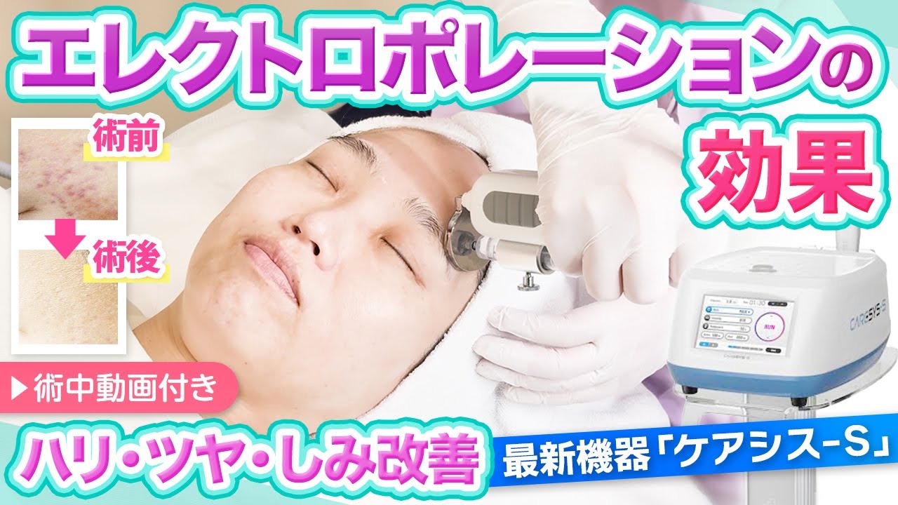 エレクトロポレーション｜埼玉県のシュシュレディースクリニック 戸田公園