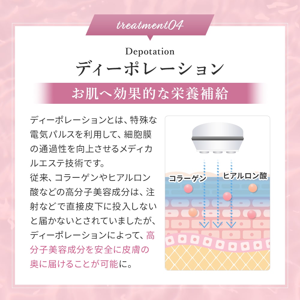 楽天市場】【正規品販売店】【シリアル付＆保証付】ベレガ セルキュア