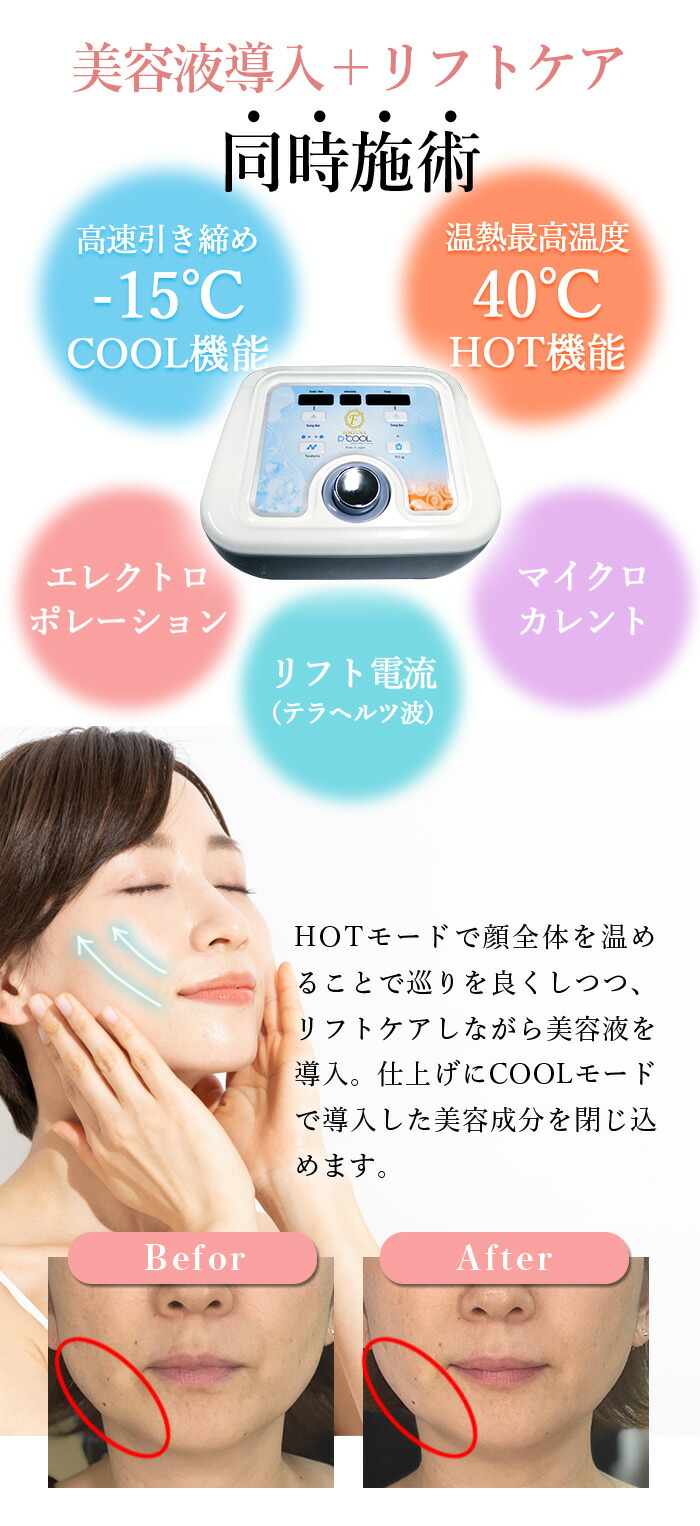 楽天市場】【レンタル/6カ月】FORTUNA D-COOL 美顔器 エレクトロポ