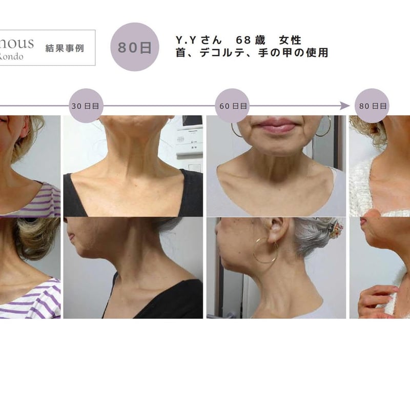 2ヶ月 定期便 10%オフ】[セインムー・ボーテロンド 30mL] 部分太り