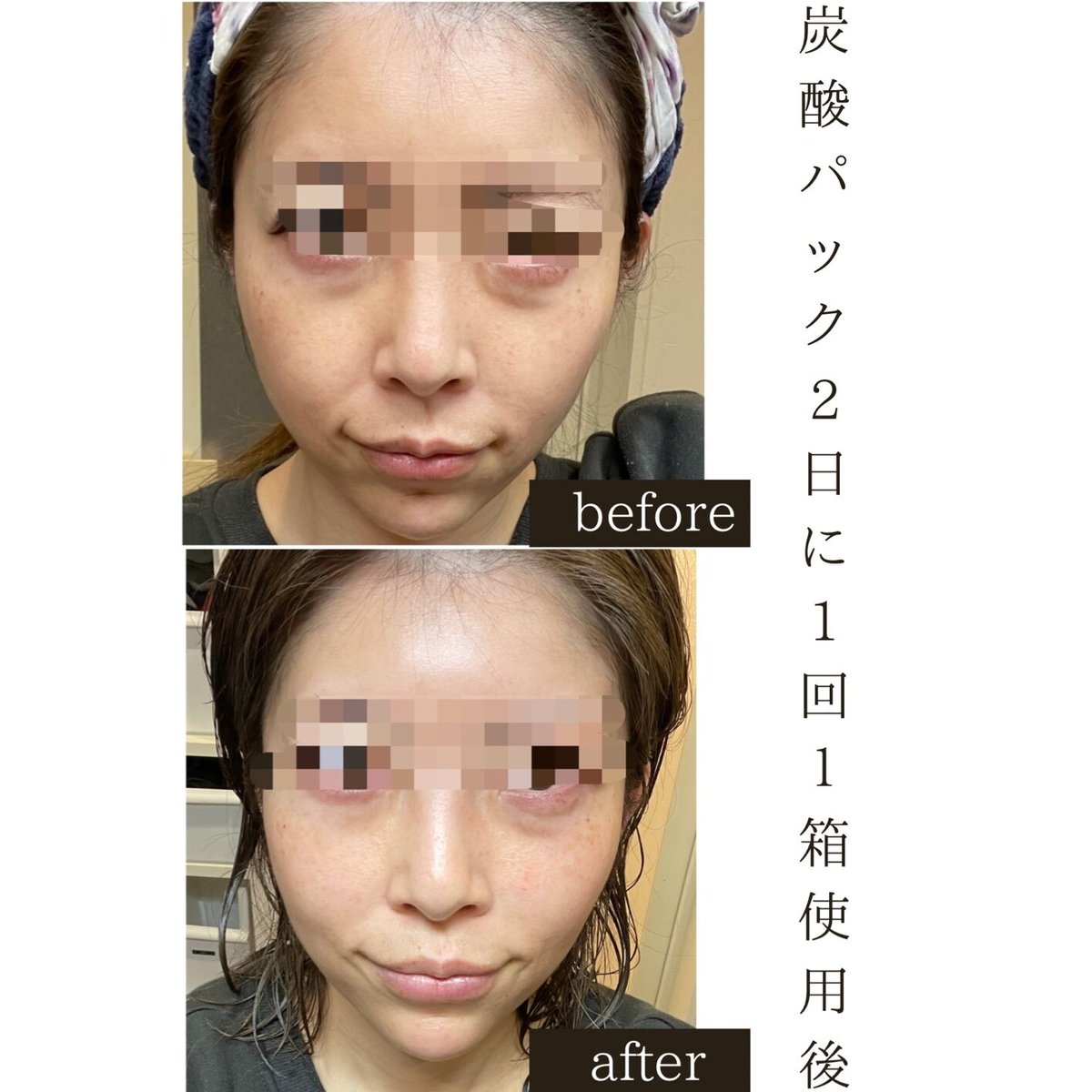 メディシュティーク 世界一の炭酸ガスパック10回分 | TT Beauty