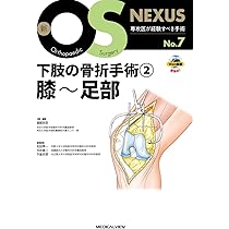 股関節の再建手術［Web動画付］ (新OS NEXUS No.8) | 松田 秀一 |本