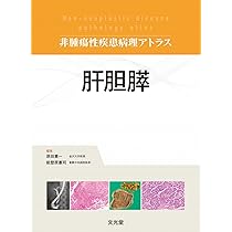 腎 (非腫瘍性疾患病理アトラス) | 大橋健一, 小池淳樹, 冨田茂樹, 原