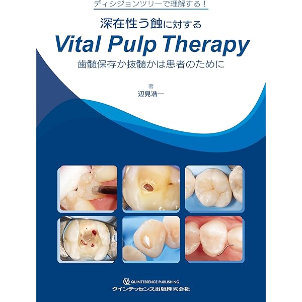 矯正が先か? インプラントが先か?: 欠損補綴の治療計画を極める | 松尾