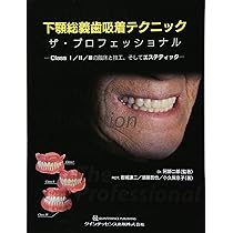 下顎総義歯吸着テクニック ザ・プロフェッショナル | 阿部 二郎, 岩城