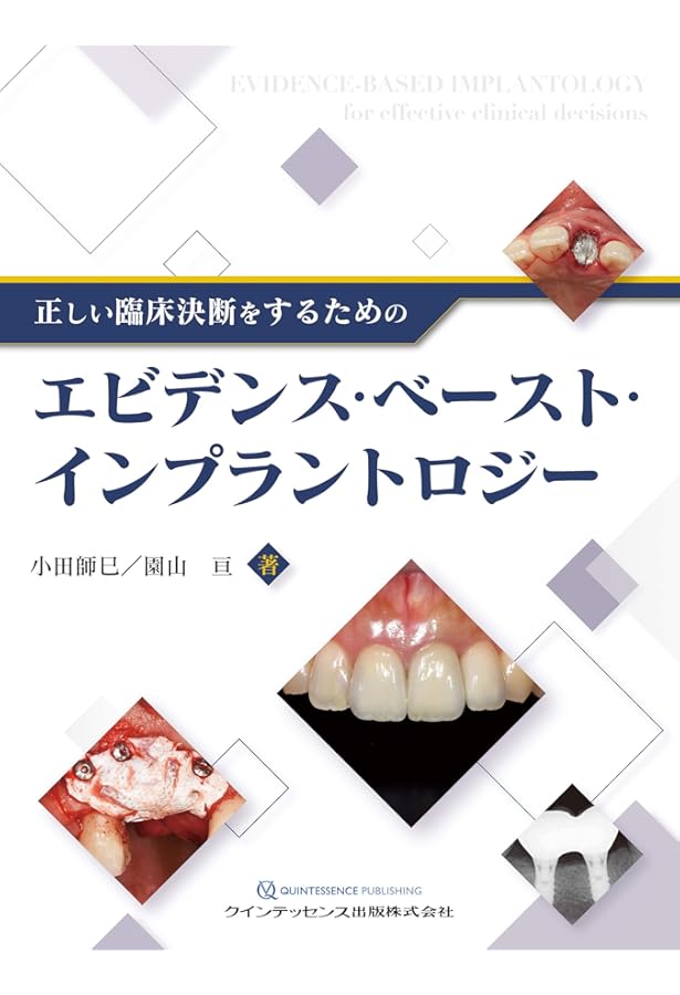 インプラントトラブルの対応策と予防策 | 鈴木 貴規 |本 | 通販 | Amazon