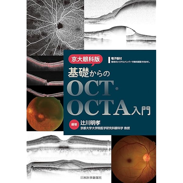 最新 眼科画像診断パワーアップ (眼科診療エクレール 2) | 辻川明孝